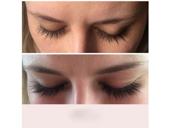 Hairplus Zero Kirpik ve Kaş Büyüme Serumu - Görsel 3